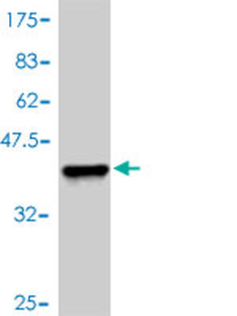 TFAP2B polyclonal antibody (A01)