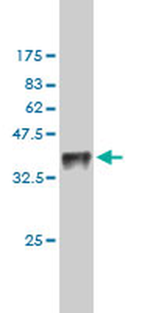 TESK1 monoclonal antibody (M01), clone 1D11