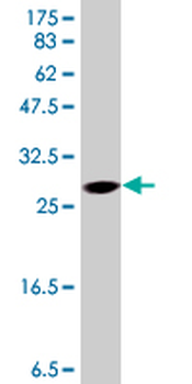 TDO2 polyclonal antibody (A01)
