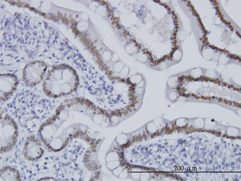 TCF7L2 monoclonal antibody (M04), clone 1A9