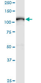 ADAM17 monoclonal antibody (M01), clone 1F6