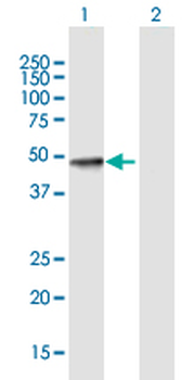 SULT2B1 purified MaxPab mouse polyclonal antibody (B01P)