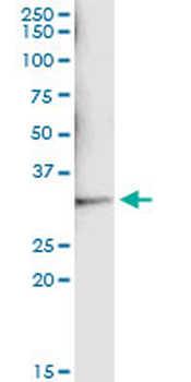 SULT1A1 monoclonal antibody (M01A), clone 1F8