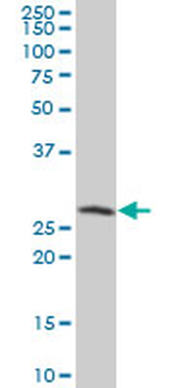 SPR polyclonal antibody (A01)