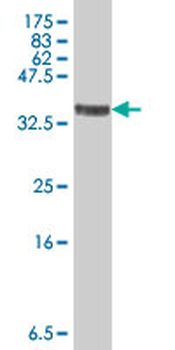 SPAM1 polyclonal antibody (A01)