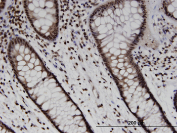 SOX10 monoclonal antibody (M01), clone 1E6