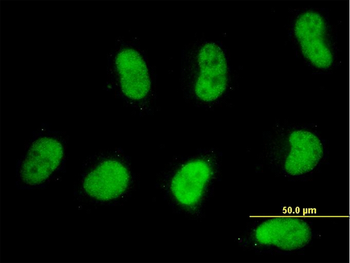 SMARCD2 monoclonal antibody (M02), clone 2B2