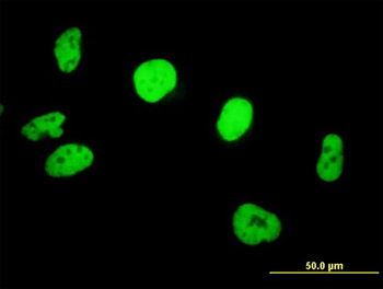 SMARCB1 purified MaxPab mouse polyclonal antibody (B01P)