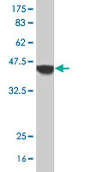 SLC22A4 polyclonal antibody (A01)