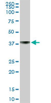 ST6GAL1 purified MaxPab rabbit polyclonal antibody (D01P)