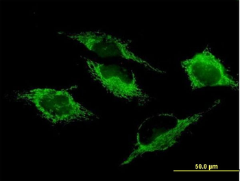 SHMT2 purified MaxPab mouse polyclonal antibody (B01P)