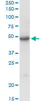SGSH purified MaxPab rabbit polyclonal antibody (D01P)