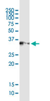 SGCG MaxPab rabbit polyclonal antibody (D01)