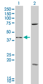 SFRP4 polyclonal antibody (A01)
