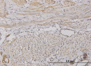 CXCL5 monoclonal antibody (M05), clone 2A9