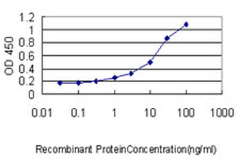 SARS monoclonal antibody (M01), clone 1H4
