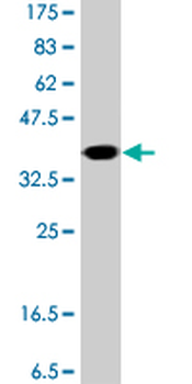 SAA4 polyclonal antibody (A01)