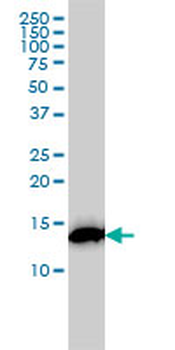 RPS19 monoclonal antibody (M01), clone 3C6