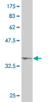 RPS6KB1 monoclonal antibody (M04), clone 4H4