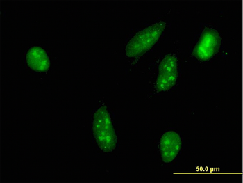 RPS6KA2 monoclonal antibody (M01), clone 1F6