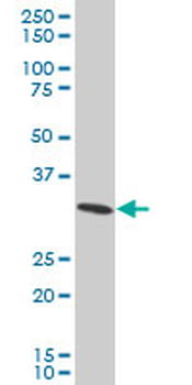 RPS3A polyclonal antibody (A01)