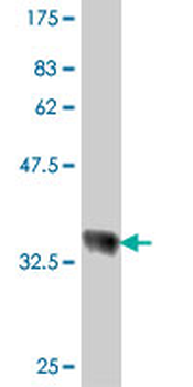 RPL18 polyclonal antibody (A01)