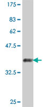 RPL11 polyclonal antibody (A01)