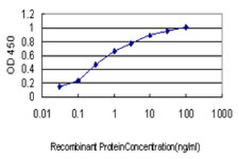 ROCK1 monoclonal antibody (M01), clone 2E2