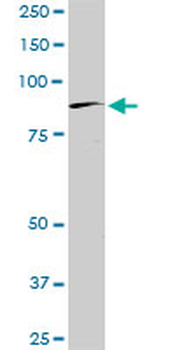 BRD2 monoclonal antibody (M01), clone 3D10