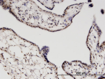 RGS13 monoclonal antibody (M06), clone 1B3