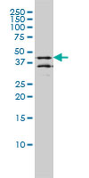 DPF2 monoclonal antibody (M01), clone 2F6
