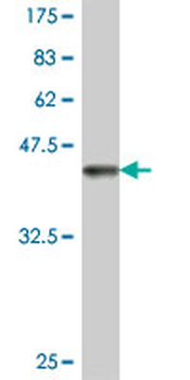 RDH5 polyclonal antibody (A01)