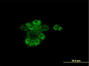 RARA monoclonal antibody (M01), clone 2C9-1F8