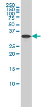 RABGGTB monoclonal antibody (M02), clone 1C2
