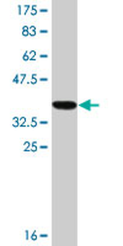 RAB1A monoclonal antibody (M07A), clone 3F10