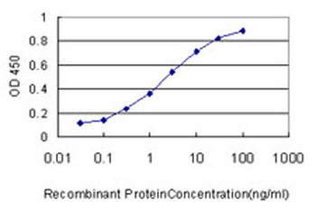 QDPR monoclonal antibody (M02), clone M1
