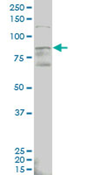 ALDH18A1 monoclonal antibody (M01), clone 2B5