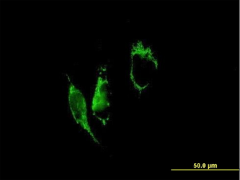 PYCR1 purified MaxPab mouse polyclonal antibody (B01P)