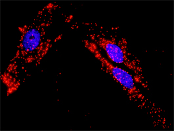 PXN purified MaxPab rabbit polyclonal antibody (D01P)
