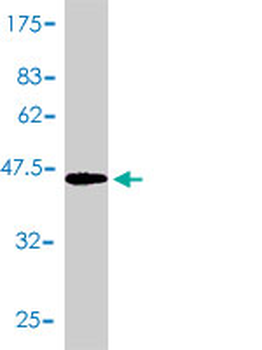 PTGDS polyclonal antibody (A01)