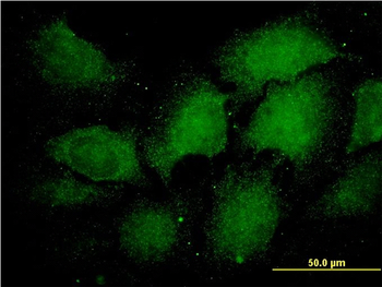 PSMA1 monoclonal antibody (M01), clone 1D9-1C7