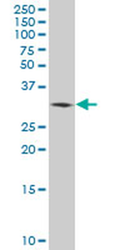 PRPS2 polyclonal antibody (A01)