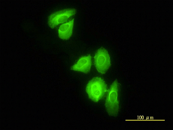DNAJC3 monoclonal antibody (M01), clone 4D3-F2