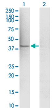 MAP2K1 monoclonal antibody (M01), clone 1B5