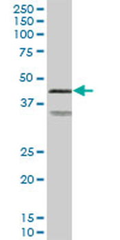 PRKAR2A MaxPab mouse polyclonal antibody (B01)