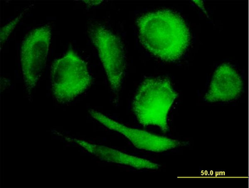 PPP5C MaxPab mouse polyclonal antibody (B01)