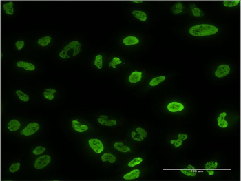 PPP3CA monoclonal antibody (M03), clone 2G8