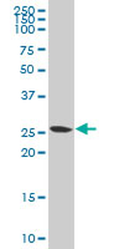 PMM2 polyclonal antibody (A01)
