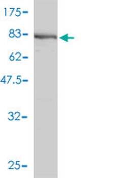 PKM2 polyclonal antibody (A01)