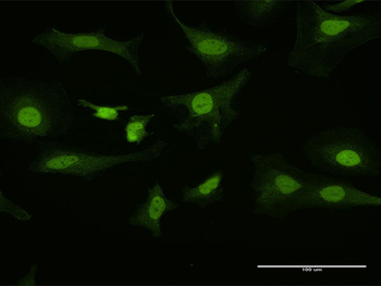 PITX1 purified MaxPab rabbit polyclonal antibody (D01P)